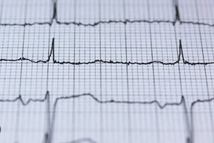 ECG: Aparelho que faz eletrocardiograma doméstico chega às farmácias do País